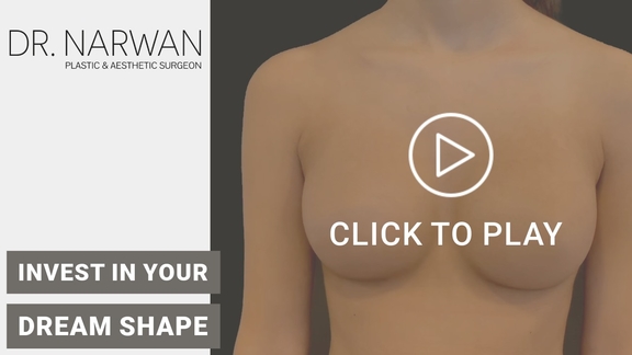 Thumbnail Video Breast Surgery Result, Dr. Narwan, Plastic and Aesthetic Surgery Dubai