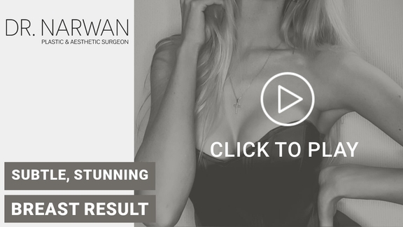 Thumbnail Video Breast Surgery Result, Dr. Narwan, Plastic and Aesthetic Surgery Dubai
